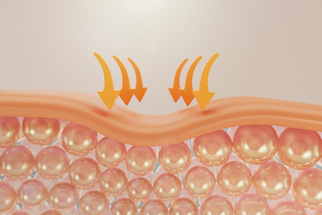 Skin Barrier