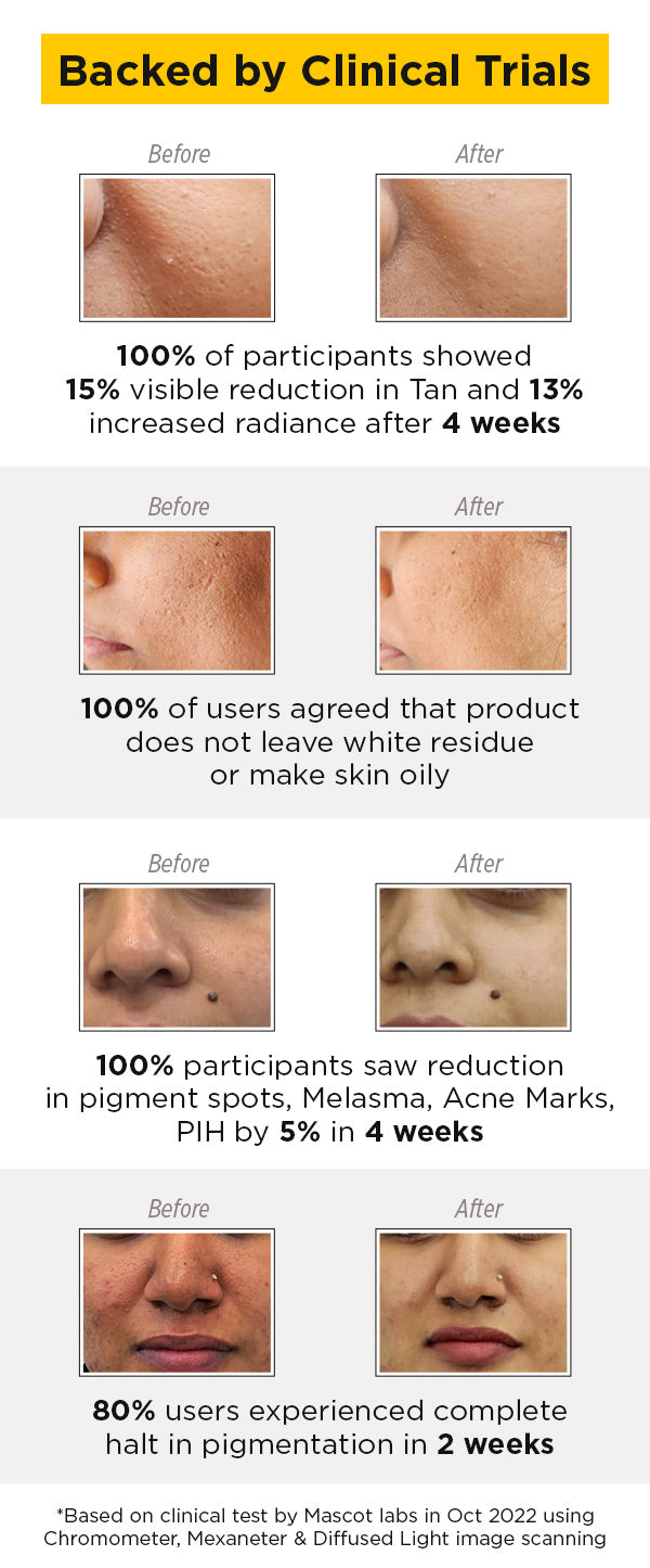SkinQ Sunscreen Gel - Reduces Tanning & Pigmentation