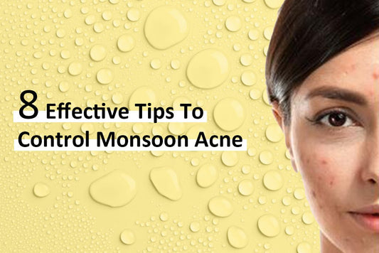 Monsoon Acne Control: 8 Effective Tips in 2024