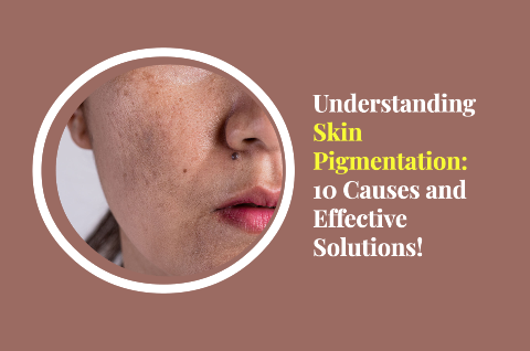 skin pigmentation causes and how to reduce pigmentation on face