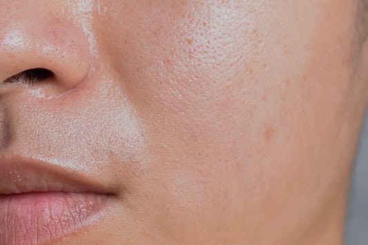 Oily Skin? This Skincare Routine Will Do Wonders for You