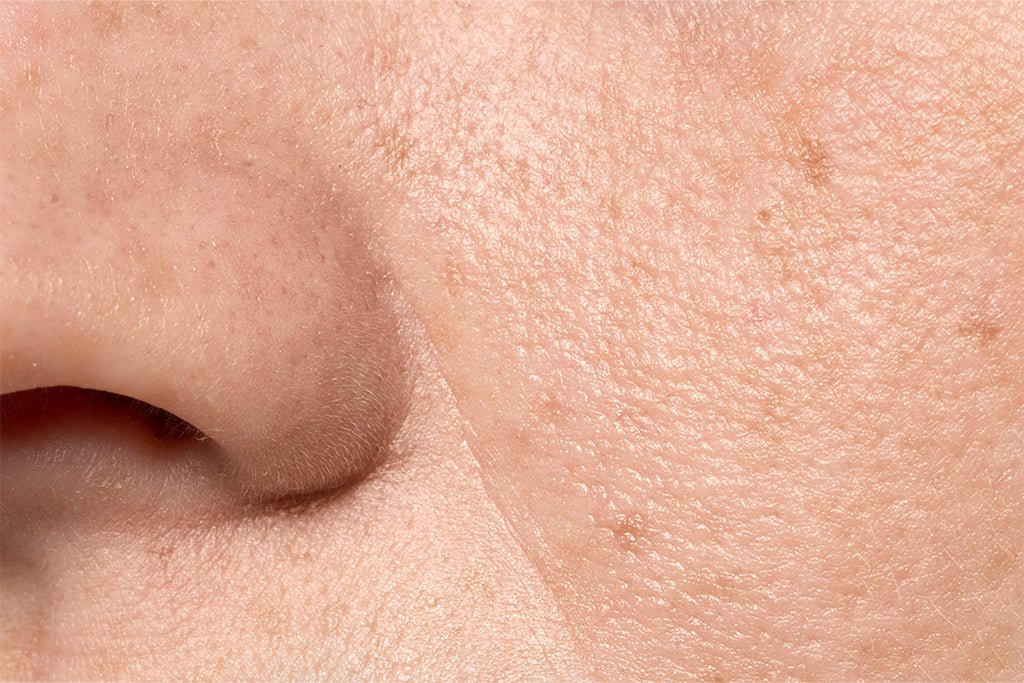 Reduce Big Pores: Easy Solutions for the Causes | SkinQ