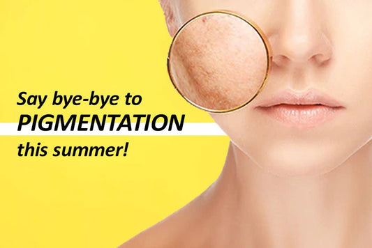 This Summer, Say Bye To Hyperpigmentation!