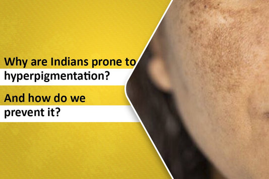 How to Prevent Hyperpigmentation on Indian Skin ?