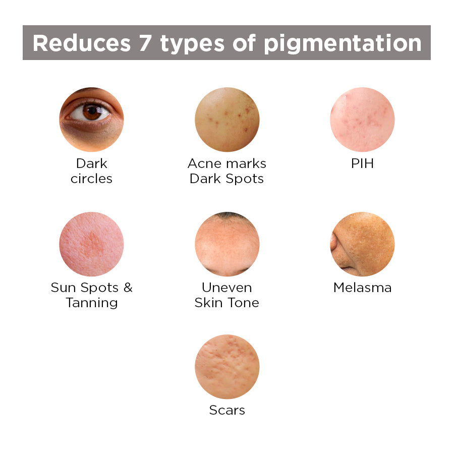 Brightening Serum for Glowing Skin : Clears Pigmentation & Dark Circles - SkinQ