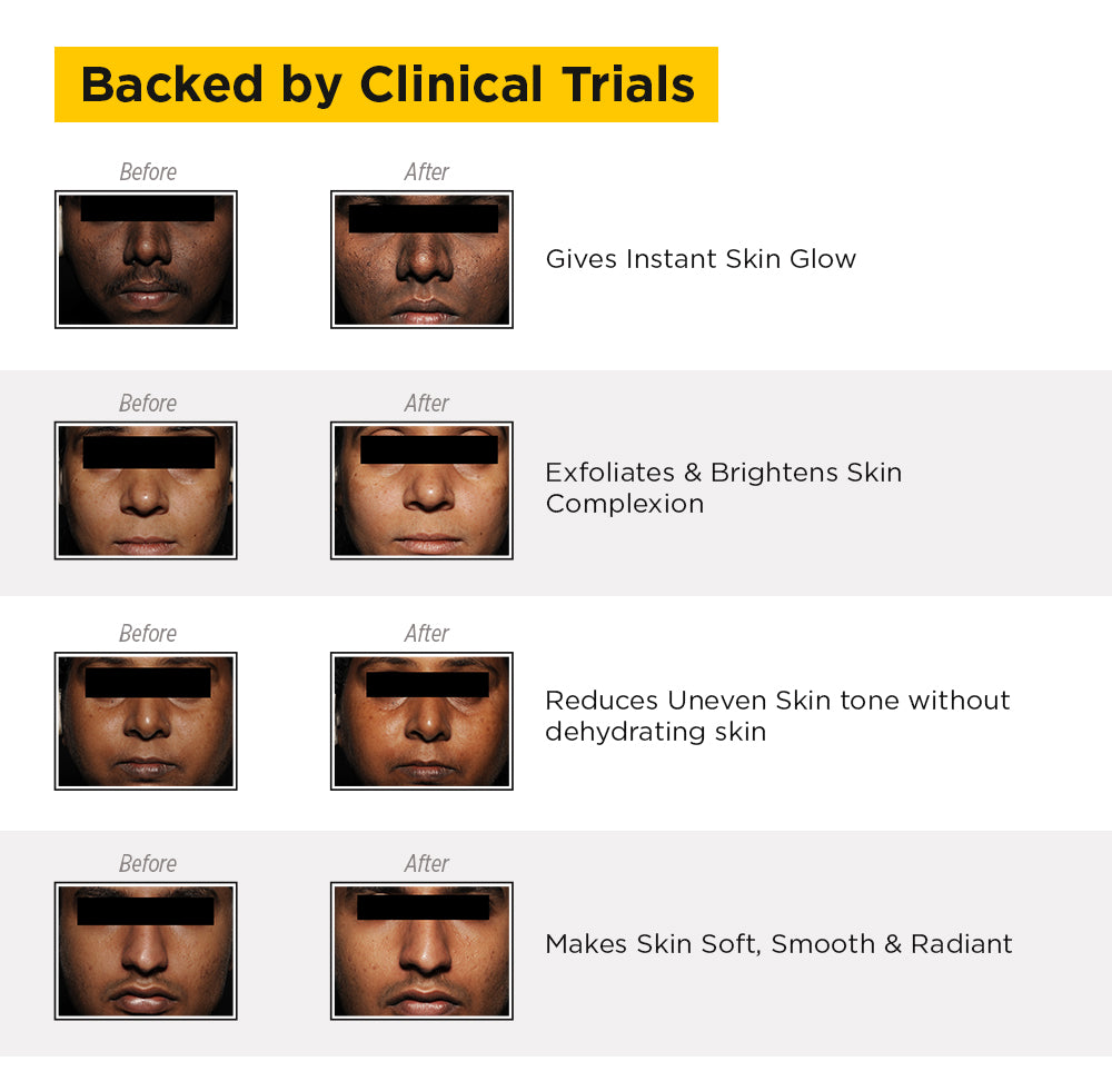 Best clinical anti tan facial kit