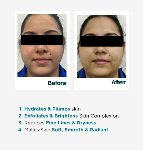 Best Result of facial kit for dry skin