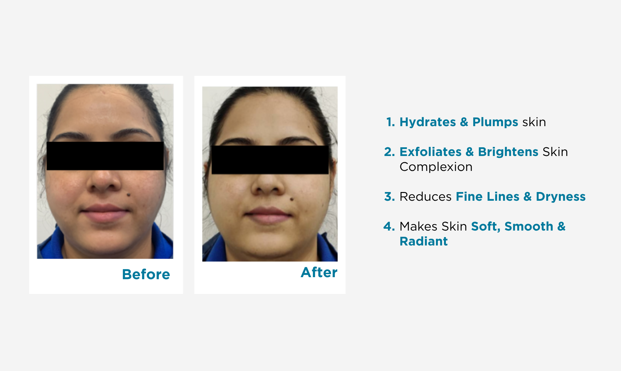 Get best result of facial kit for dry skin