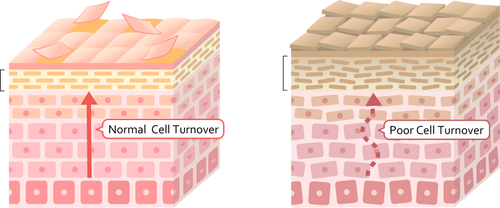 Poor Cell Renewal in Melanin skin