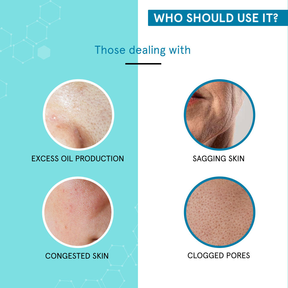 Open Pore Control Kit- For Moderate Pores - SkinQ
